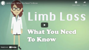 What is CDPAP resource center limb loss video