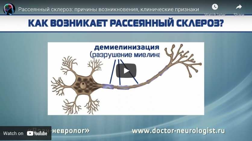 chronic arthritis video in Russian for New York Home Care Agency resource page