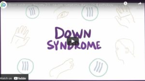 down syndrome cdpap resource video